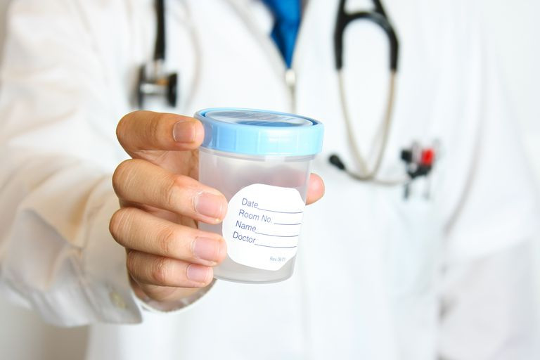 Tại sao phải xét nghiệm tinh dịch đồ? Các chỉ số cho biết gì?